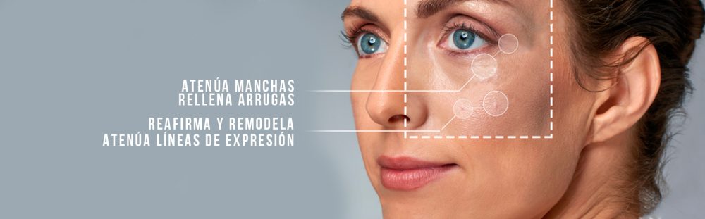 ¿Atenuación de manchas y relleno de arrugas sin cirugía?