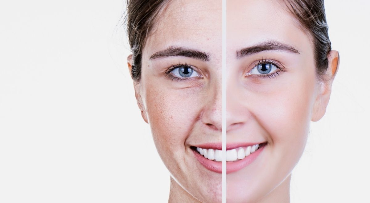 Fisetin has anti-aging properties Fisetin has anti-aging properties