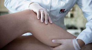 lesiones vasculares en la piel