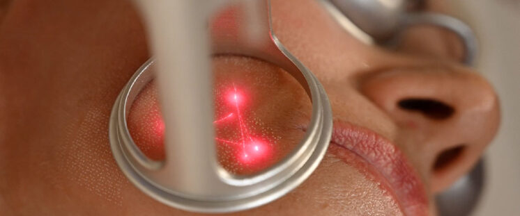 MASTERCLASS LÁSER CO2