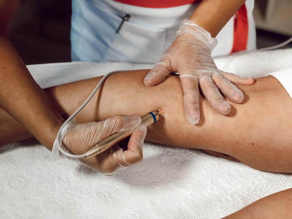 Laserterapia para lesiones vasculares
