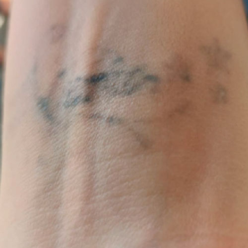 Después: atenuación marcada de la tinta, pérdida de definición y aclaramiento general (respuesta parcial).