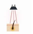 Láser CO2: ablación puntual con depósito térmico en epidermis y dermis.